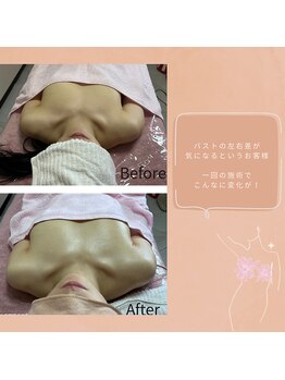 チュラ 大宮店(Chura)/左右差が劇的に改善!!(2/2)