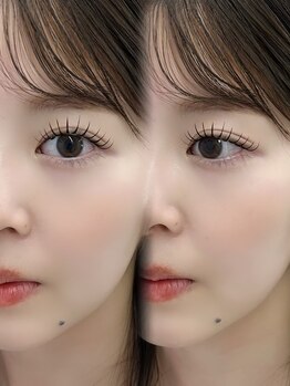 ベリーニ(Be.llini.)/担当staff:Hina