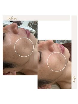 ファロンビューティー(fallon beauty)/お客様ビフォー×アフター