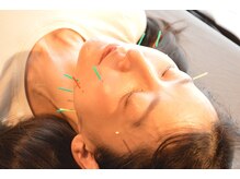 リト ツクバ(Ret Tsukuba)/小顔美容鍼