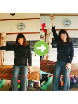 サプライズ整体院/30代ママさんの肩こり初回結果