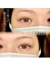 クレー(Klee)/アンドヘルシー