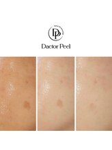 ブロッサム(Blossom)/水光肌ダクトピール