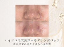 アネラボーテ(Anela Beaute)/ラフォス＋ハイドロ毛穴洗浄