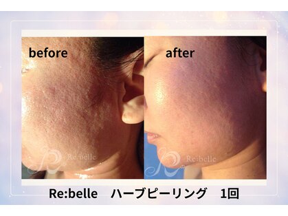 サロン ド ボーテ ラニ 戸塚店(LANI)の写真