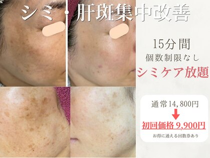 アトリア(ATRIA)の写真