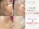 アトリア(ATRIA)の写真