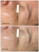 シトロン(citron)/