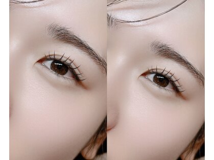 リノ(Lino)の写真