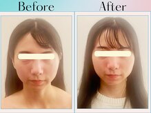 天空の手もみ/小顔矯正/吉祥寺/荻窪/西荻窪