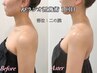 ブライダル☆痩身エステ☆ドレスから見える部位のみ施術　　￥11,000