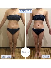 エスプライザ 鹿児島天文館店(ESPLIZA)/