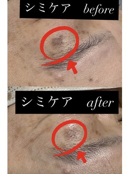 アンベリー ひびきの(embellie)/