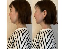 カラダミックス(karadamix)/フェイスライン　１回ケア