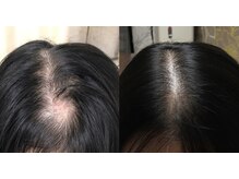 アブソリュートワン(absolute1)