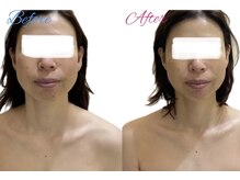 グレイスシャイン(GraceShine)/【レモンボトル】