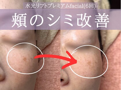 ミトラ(MITRA)の写真