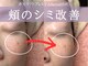 ミトラ(MITRA)の写真