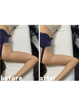 エクスクラメーションマーク(!!!)/★二の腕★