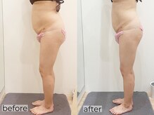 ラディアントモア(radiant more)/筋膜リリース×リンパマッサージ