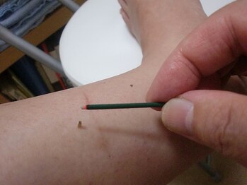 クシロ鍼灸整骨院/【元気に出産できるよう◎】お灸