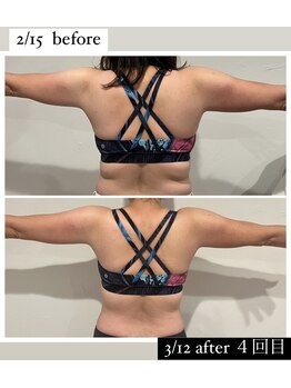 レナセール(Renacer)/痩身メニュー