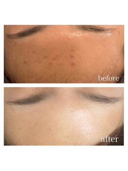 パールムーン(pearl moon)/正しいスキンケア