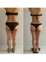 カーム整骨院/ダイエット整体ビフォーアフター