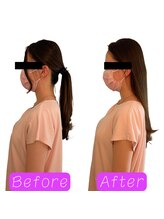 鍼の魔法 恵比寿院/首肩こり　施術回数:1回