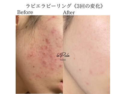 ハワイアンロミロミアンドビューティーサポートサロン ラプア(Lapua)の写真