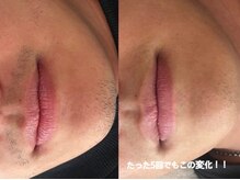 ジョワ 黒崎店(joie)/