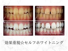 ホワイトニングショップ 多摩店の雰囲気（通うほどに白くなります♪あなたの歯も白くしてみませんか？）