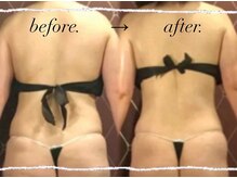 デアルーチェ(DEA LUCE)の雰囲気（背中のエイジングケア。ハイパーナイフ痩身で後ろ姿を美しく。）