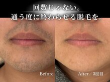 ダイヤ(Daiya)の雰囲気（【メンズ脱毛】ヒゲ脱毛もハイパワー!!全身脱毛/VIO脱毛/眉毛/顔）