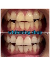 ホワイトニングショップ 武蔵小杉店/武蔵小杉ホワイトニング美白ケア