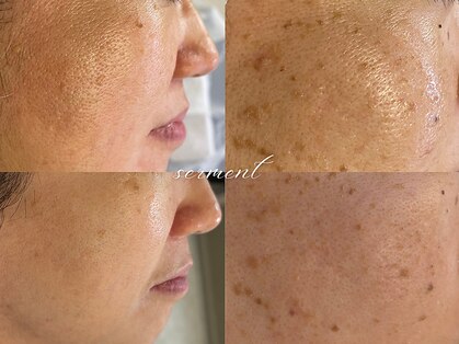 ボーテラボ 大宮(beaute LABO)の写真