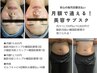 【サブスク】脂肪冷却 安心毎月定額払いプラン☆カウンセリング|当日施術可能