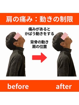 ララ鍼灸サロン(LaLa鍼灸サロン)/寝違え即解消