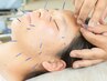 【しわ・たるみに特化】フェイシャル美容鍼×肩回り＋ヘッドスパ　60分