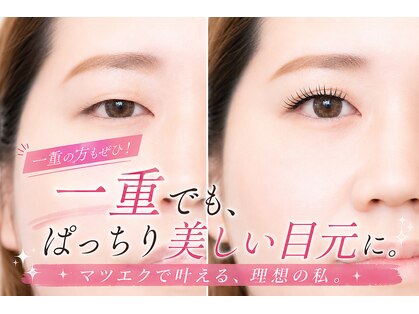 グリッター(glitter)の写真