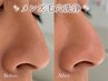 【メンズ☆にオススメ】毛穴ごっそり洗浄で毛穴のザラつきにサヨナラ