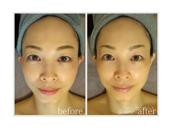 アン グレーヌ 自由が丘(unegraine)/健康的でハツラツとした印象に！