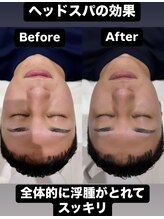 リンパアクティベーション オオサカ(リンパアクティベーション Osaka)/効果写真