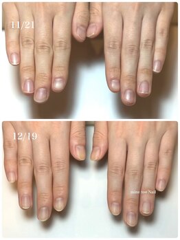 マイントゥ ネイル(mine too nail)/貝爪のお悩みも!