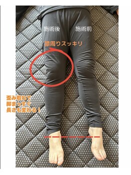 ヨサパーク フラネ(YOSA PARK Flaner)/深部マッサージ