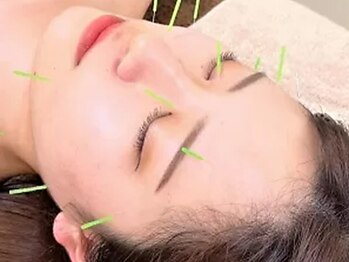 神田鍼灸整骨院の写真/【美容鍼×小顔矯正】身体と美のプロによる信頼技術◎美肌/小顔/エイジングケアも叶う◎『鍼』初体験歓迎！