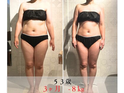 サンテボーテ(Sante Beaute)の写真
