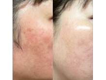 キレイになる路の雰囲気（乳菌美人蒸しだけでこれだけの美しさ）