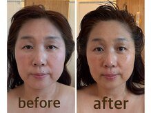 ロータスサリ/インディバフェイシャル/正面