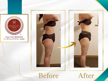 まるる/最近痩身マシンハイパーナイフ7